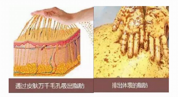 減肥行業(yè)發(fā)展迅猛 白華瘦美人“脂肪管理”引發(fā)關注